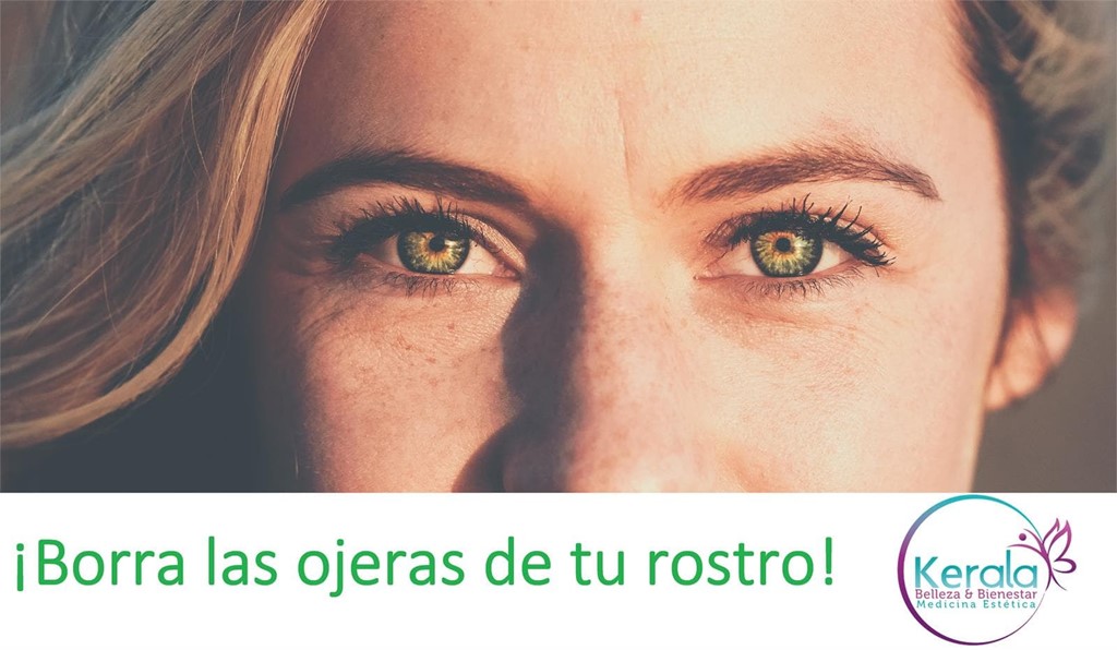 ¡Borra las ojeras de tu rostro!